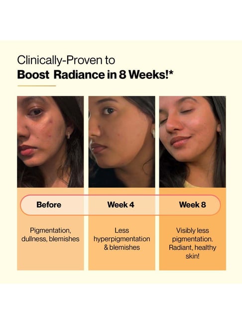 glutathione pills before and after Setu Mixed Berry Flavour Skin Renew Glutathione Tablets for Glowing Skin
