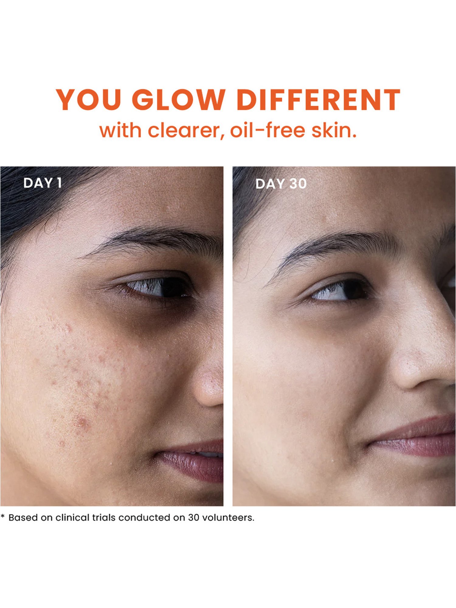 Foxtale Acne Control Cleanser — Flash AI Score 89/100